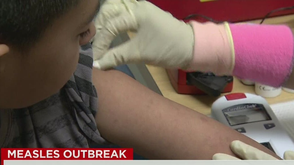 California measles outbreak grows to 68 cases, 48 of them linked.