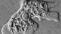 How dangerous are brain-eating amoebas?
