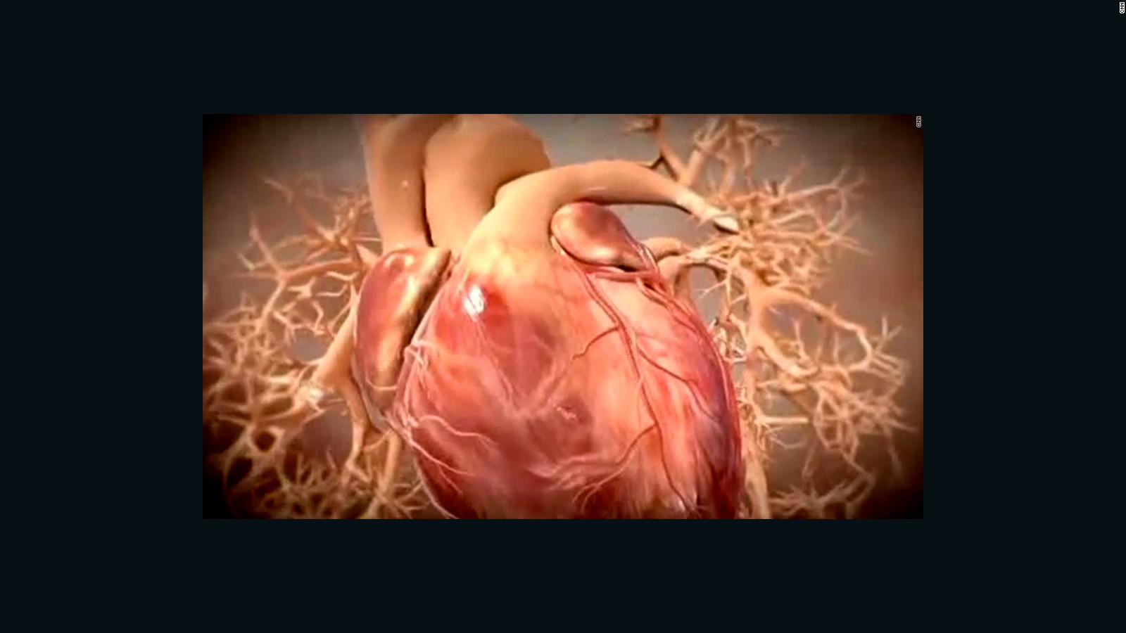 No. 1 killer: Cancer is catching up to heart disease