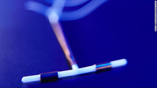 Iuds Implants Vastly More Effective Than The Pill 0448