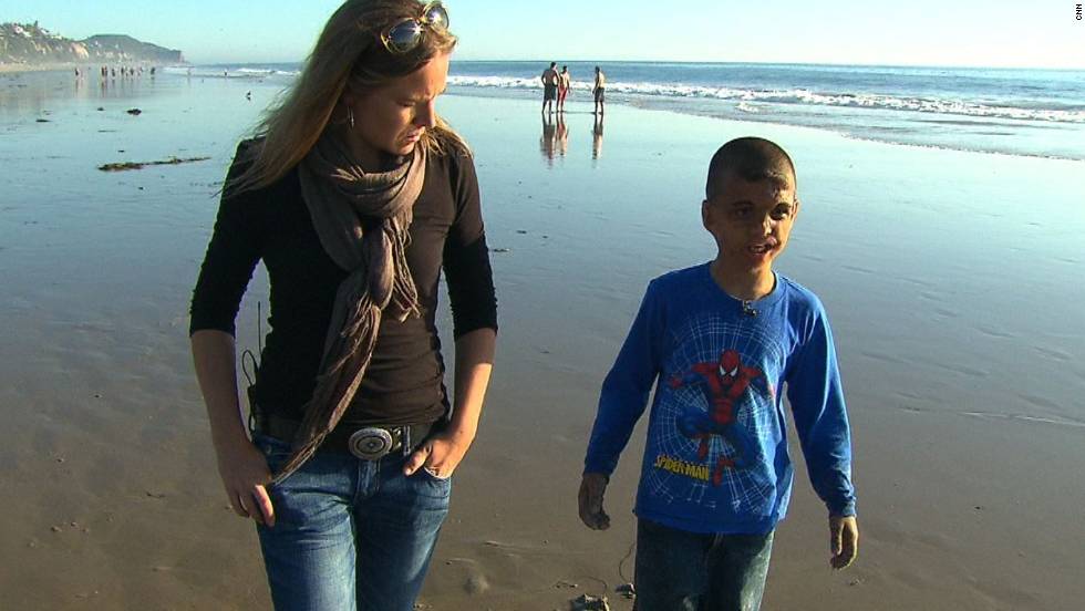 Youssif walks along a California beach in 2011 with CNN&#39;s Arwa Damon, who first told the boy&#39;s story in 2007.