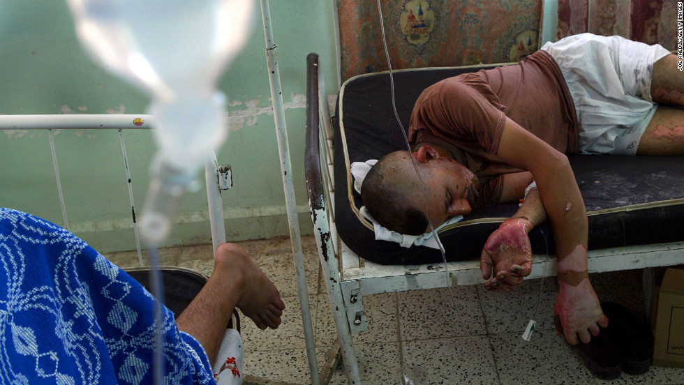 Iraqi national guardsman Ridha Abdulkarim lies in a hospital bed after a car bomb detonated at a checkpoint in Baquba on August 3, 2004. The bomb killed six guardsmen and wounded six others, Iraqi authorities said.