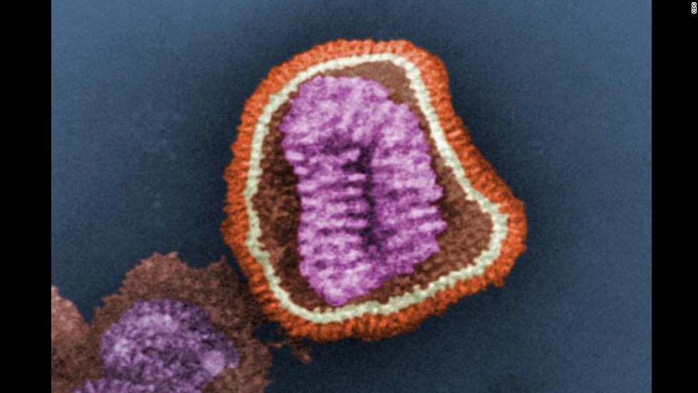Photos Flu under the microscope