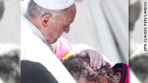 Meet the disfigured man the Pope kissed