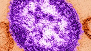 A single virus particle of measles virus