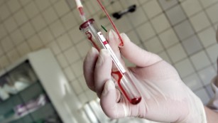 TO GO WITH AFP STORY ' Les enfants du sida, parias de la societe en Russie' (FILES) This file picture taken 19 June 2006 shows a nurse holding a test-tube with HIV positive blood in an infectious diseases hospital in Moscow. About 330,000 people in Russia carry the virus, 50,000 of them aged between 15 and 19, and more than 1,500 babies born to HIV-positive mothers are given up every year. AFP PHOTO / MAXIM MARMUR (Photo credit should read MAXIM MARMUR/AFP/Getty Images)