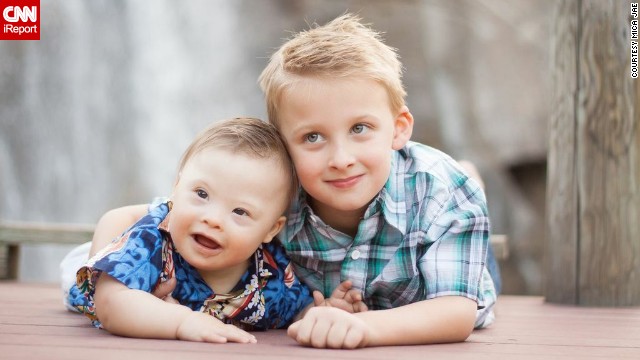 Down Syndrome Fast Facts