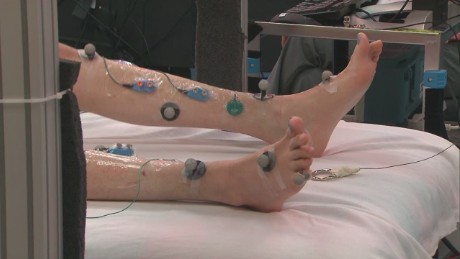 New science helps a paralyzed man move his legs for the first time in years