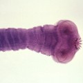 brain worm Taenia solium