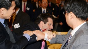 U.S. ambassador leaves hospital after knife attack