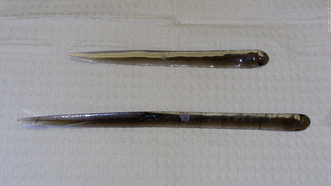 obsidian scalpel blades