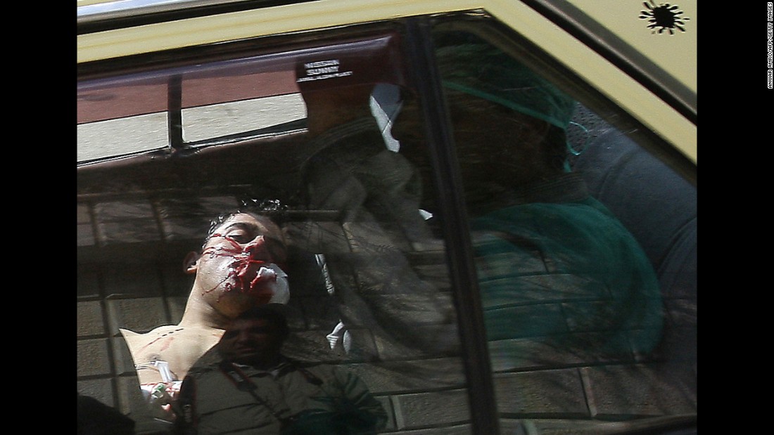 An injured man lying in the back of a vehicle is rushed to a hospital in Daraa, south of Damascus, on March 23, 2011. Violence flared in Daraa after a group of teens and children were arrested for writing political graffiti. Dozens of people were killed when security forces cracked down on demonstrations.