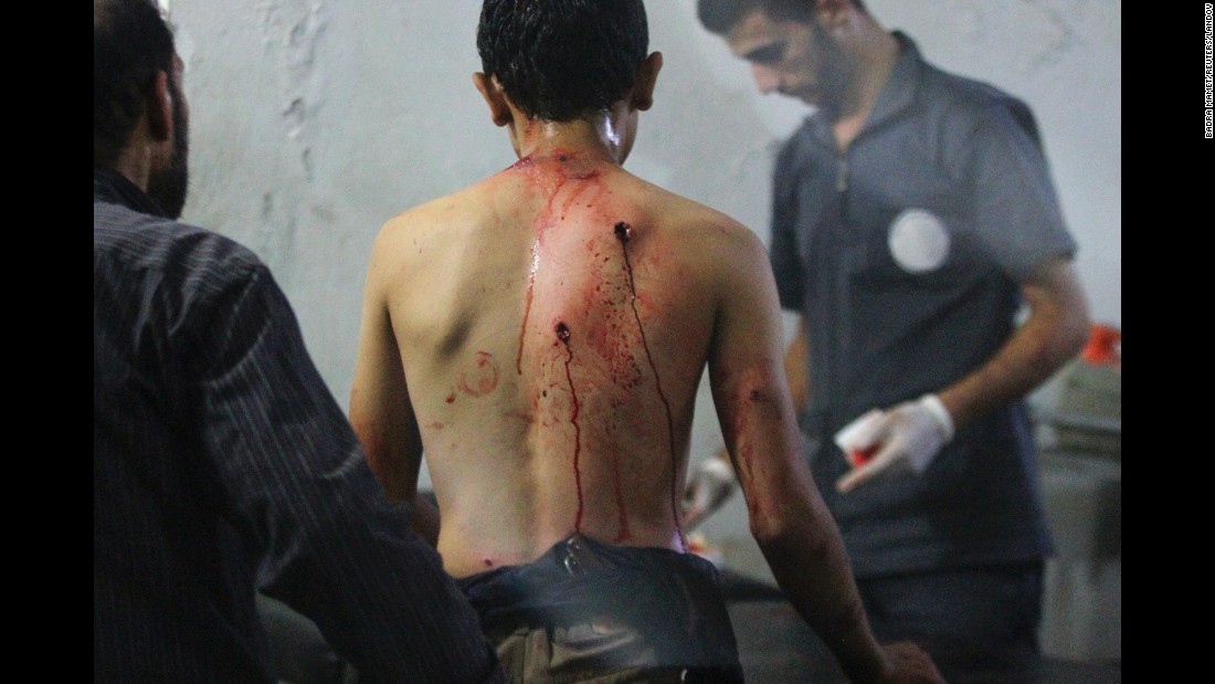 Medics tend to a man&#39;s injuries at a field hospital in Douma after airstrikes on September 20, 2014.
