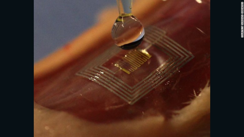 This healing silk &#39;microchip&#39; could be implanted under the skin.