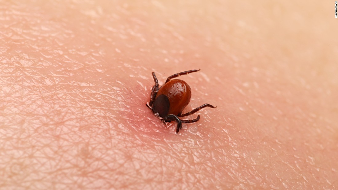 Fire Ant Bites: Treatment, Symptoms, What They Look Like ...