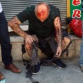 A wounded man waits for medical attention shortly after an explosion in the southeastern Turkish city of Suruc near the Syrian border, Turkey, Monday, July 20, 2015, An explosion Monday killed at least 10 people and injured scores of others in the southeastern Turkish city of Suruc near the Syrian border, state-run Turkish news agencies reported. The private Turkish DHA news agency said at least 50 people had been hospitalized in the midday explosion. There was no immediate claim of responsibility for the blast. (AP Photo/Ozcan Soysal ) TURKEY OUT