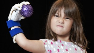 Hailey Dawson poses with her robohand in October 2014 at the University of Nevada, Las Vegas. 