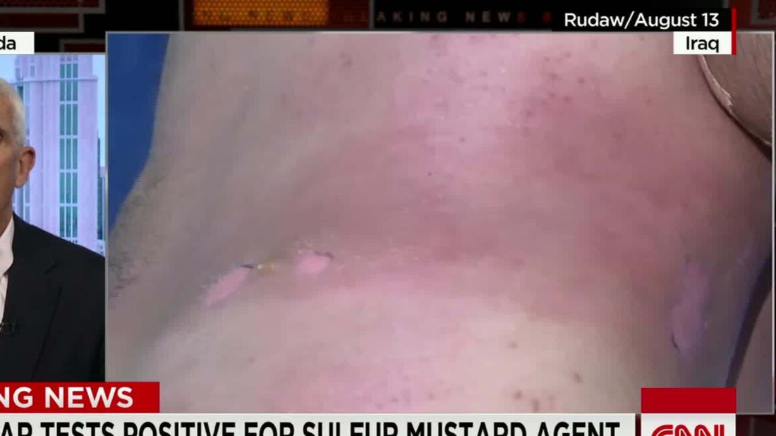 US: No mustard agent in ISIS base attack