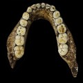 RESTRICTED Homo Naledi Jaw Wits