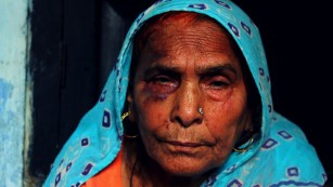Asghari Begum sits broken and bruised after Monday&#39;s mob attack.