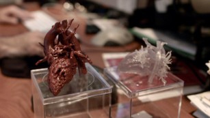 Mia&#39;s surgeon carried around a model of the girl&#39;s heart for weeks.