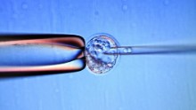 The concept of stem cells, the idea of an original single cell acting as an ancestor for all organic beings, was first hypothesized in the late 19th century. But it wasn't until the 1950s that researchers found adult stem cells in bone marrow that could develop into different types of cells. This work led to the first human bone marrow transplant. It took another 40 years before human embryonic stem cells were derived, unleashing the potential for new drugs and therapies for a range of diseases like ALS, Alzheimer's, cancer and even blindness.