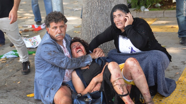 Wounded people wait for help at the site of an explosion in Ankara, Turkey, Saturday, Oct. 10, 2015. Two bomb explosions apparently targeting a peace rally in Turkey&#39;s capital Ankara on Saturday has killed over a dozen people, a news agency and witnesses said. The explosions occurred minutes apart near Ankara&#39;s train station as people gathered for the rally organized by the country&#39;s public sector workers&#39; trade union. 