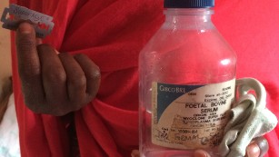 A Kenyan "cutter" (Female Genital Mutilation practitioner) holds up the razor blades and ethanol spirit used FGM. 
