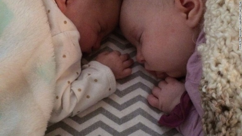 Teegan, left, and Riley Lexcen were born in August.