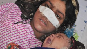 afghan woman nose cut off by husband kinkade pkg_00024505.jpg