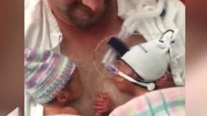 preemie twins hold hands Daily Hit NewDay_00003719.jpg