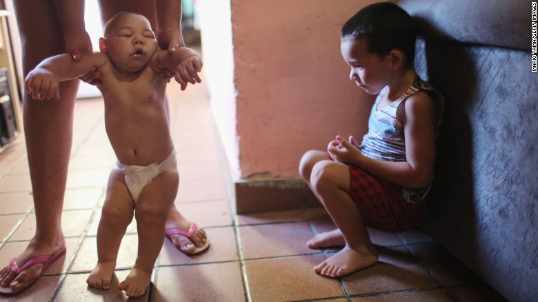 David Henrique Ferreira, a 5-month-old who has microcephaly, is watched by his brother in Recife, Brazil, on Monday, January 25. Since November, Brazil has seen nearly 4,000 cases of microcephaly in babies born to women who were infected with Zika. The disorder results in newborns with abnormally small heads and abnormal brain development.