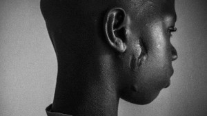 Demba Fati, 14, outside the medical support room of Mason de La Gare center in St. Louis, Senegal, May 20, 2015. His marabout beat him with an iron rod after he tried to escape. Since then he goes to the center whenever he needs medical care.