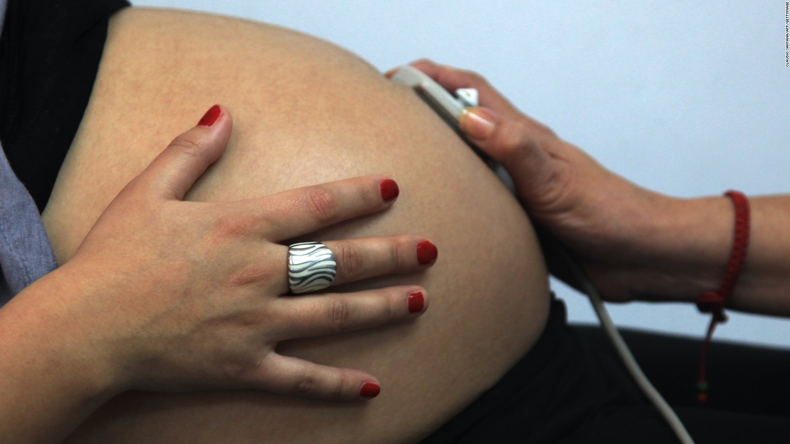 Fewer U.S. teens are giving birth, CDC finds