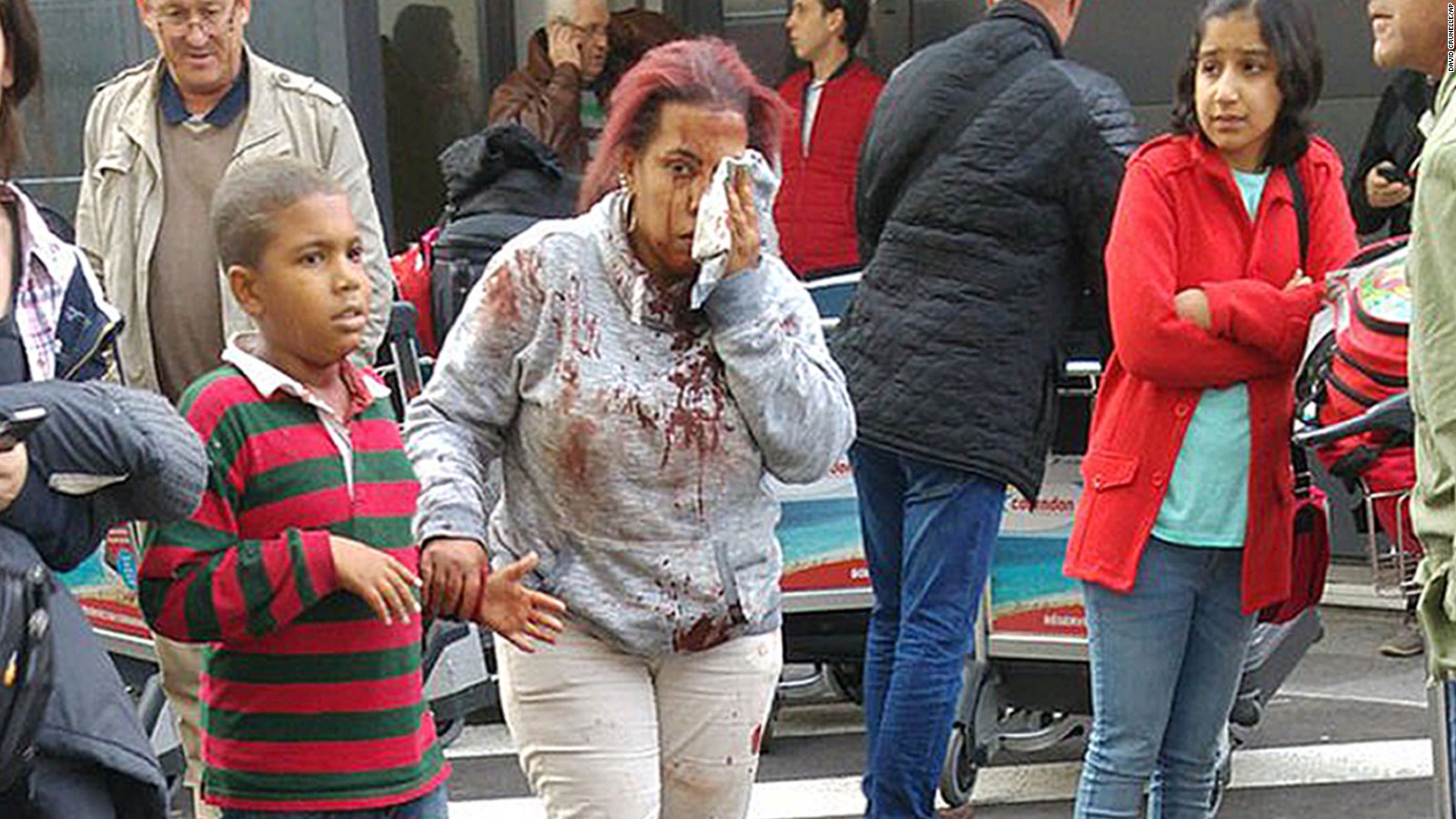 An injured woman leaves the scene at Brussels airport, after explosions rocked the facility in Belgium on March 22.