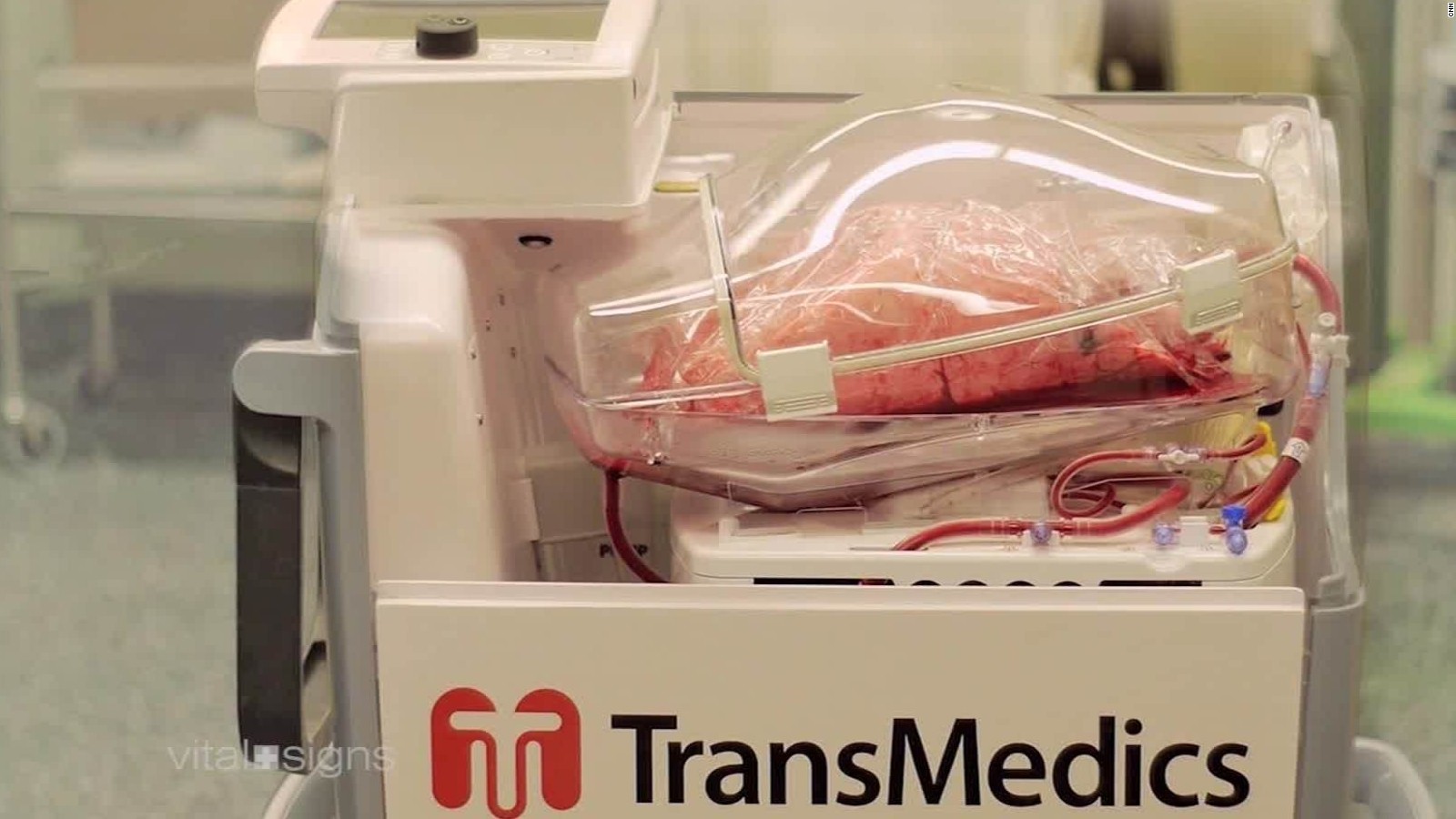 TransMedics device keeps organs alive outside the body