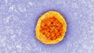 Hepatitis C deaths hit all-time high in United States