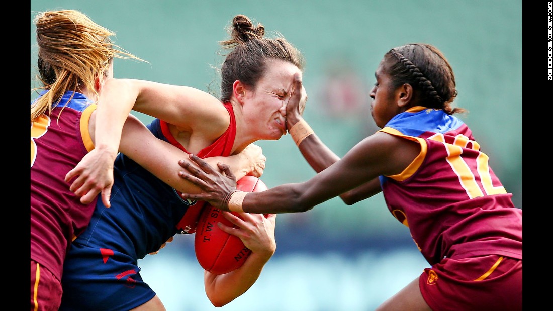 Melbourne&#39;s Daisy Pearce catches a hand to the face during an Australian Football League match on Sunday, May 22.