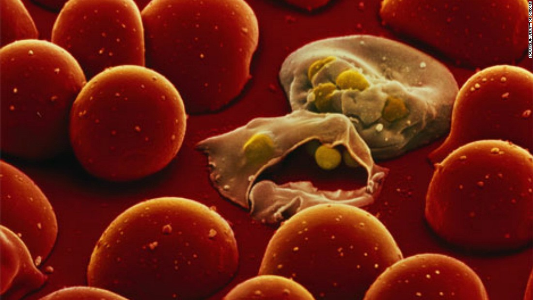 The life cycle of the malaria parasite is complex and has many stages of development inside the human body. One stage is their transformation into &#39;merozoites&#39; where they infect blood cells and replicate inside them, growing in number until the cells burst (pictured) releasing them into the bloodstream to infect more cells.