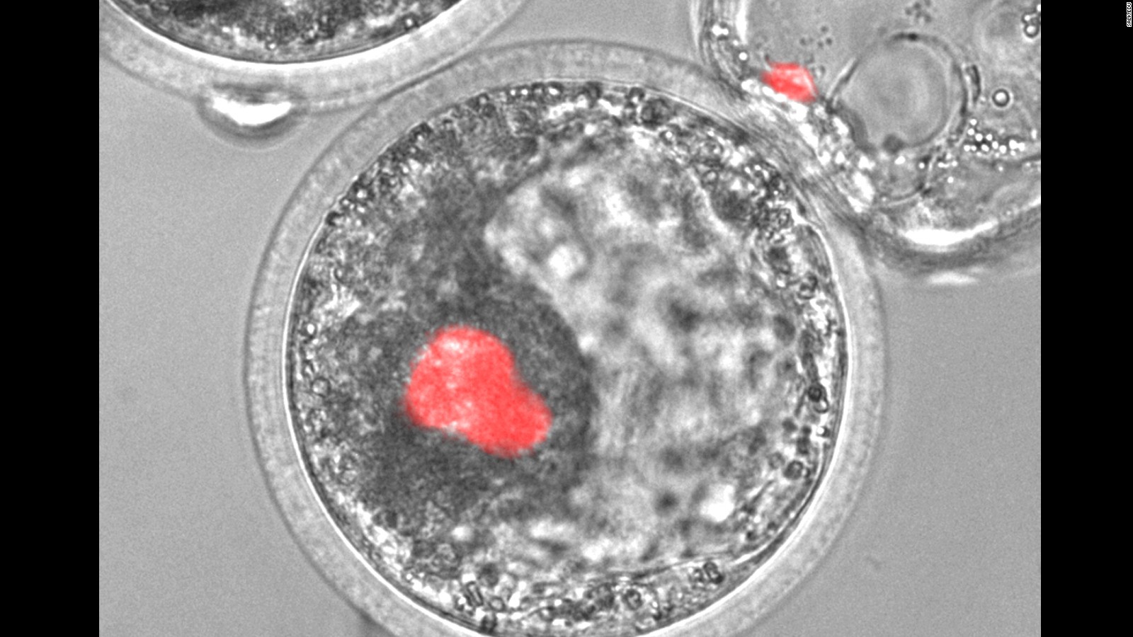 Human organs grown in pigs may help transplant patients, scientists say