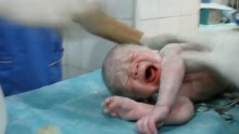 When doctors pulled the baby out he wasn't breathing.