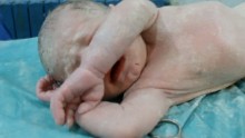 The boy takes his first breath and starts to cry.