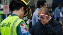 A man hurt in the crash is treated for a facial injury.