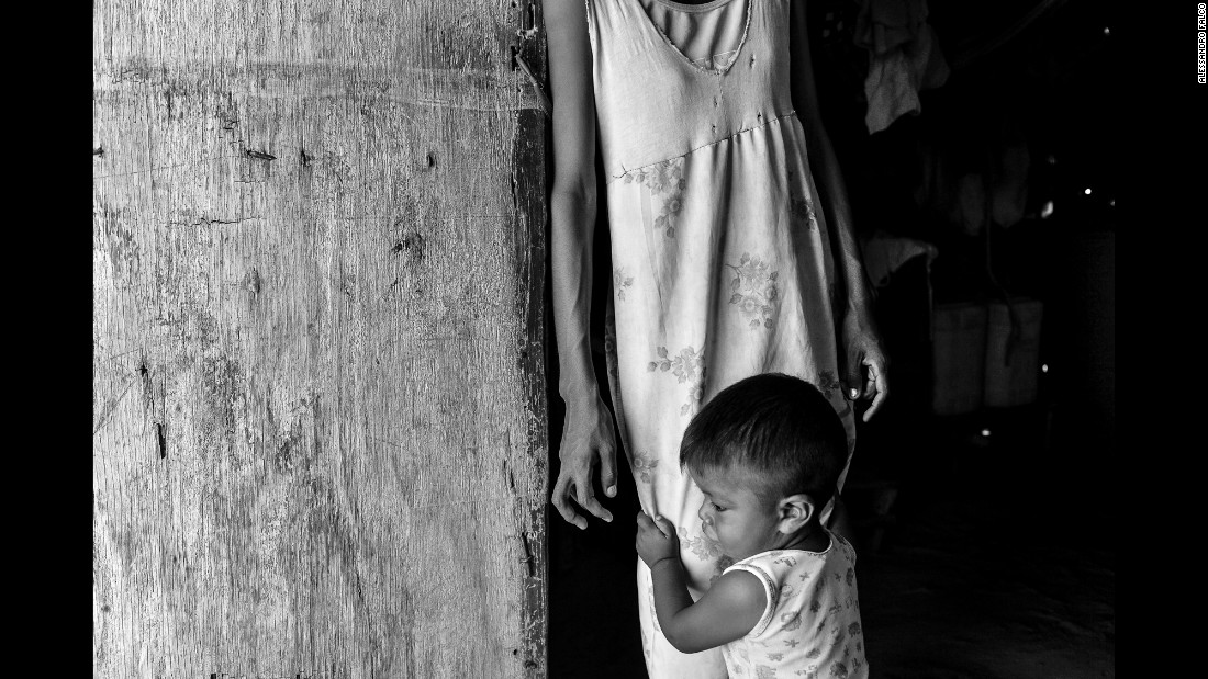 The Face Of Hunger In Venezuela