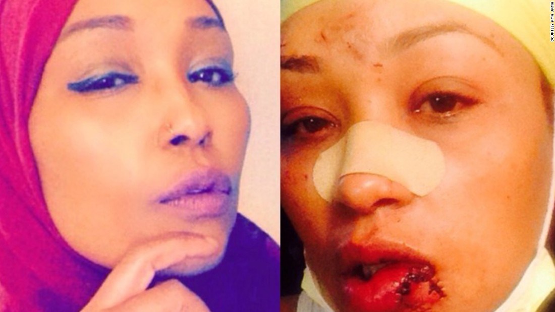 Hit with beer mug for speaking Swahili