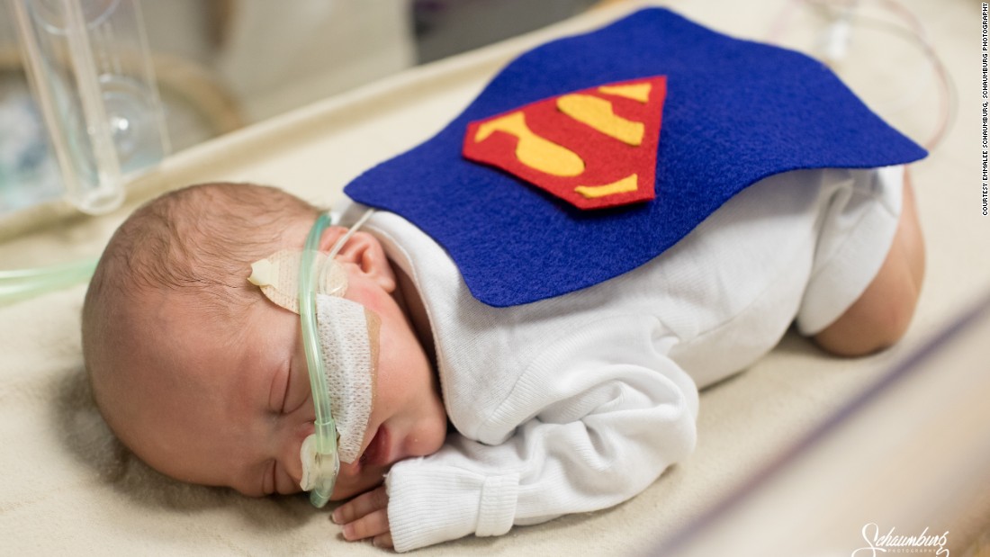 NICU babies get handmade costumes for first Halloween at St. Luke hospital