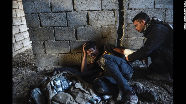 An injured Iraqi counter-terrorism soldier injured during clashes with ISIS fighters on the eastern edge of Mosul on Monday.