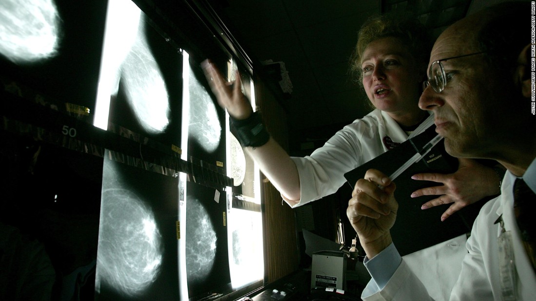 Women's cancer deaths expected to rise 60% by 2030