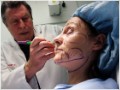 What tummy tucks can teach us about health care reform