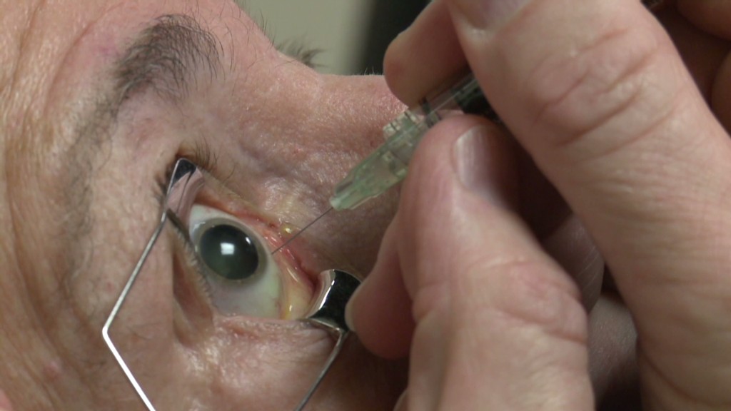 How Much Avastin Is Injected Into The Eye